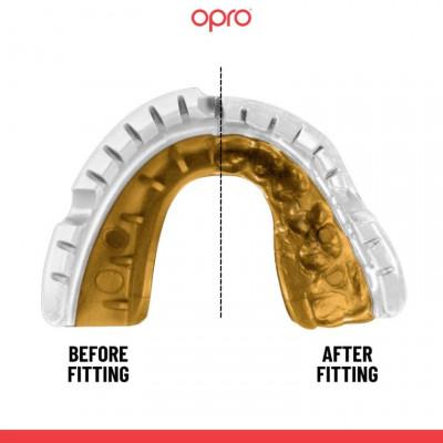 Капа OPRO Gold Braces White/Gold (02714) фото 2
