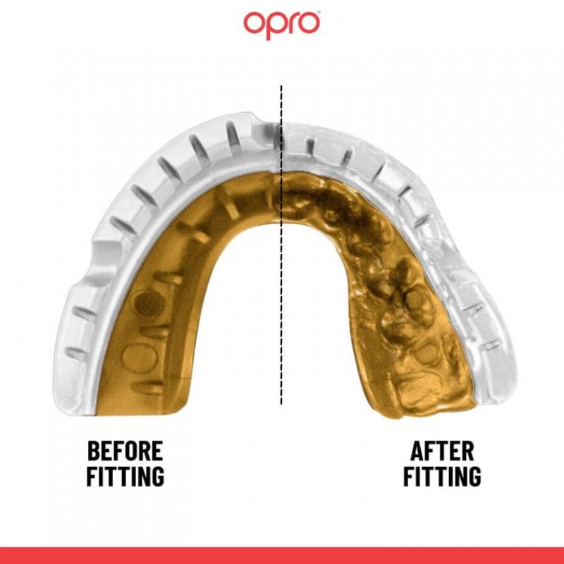 Капа OPRO Gold Braces White/Gold (02714) фото 2